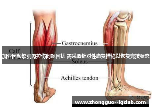 加亚因频繁肌肉拉伤问题困扰 需采取针对性康复措施以恢复竞技状态